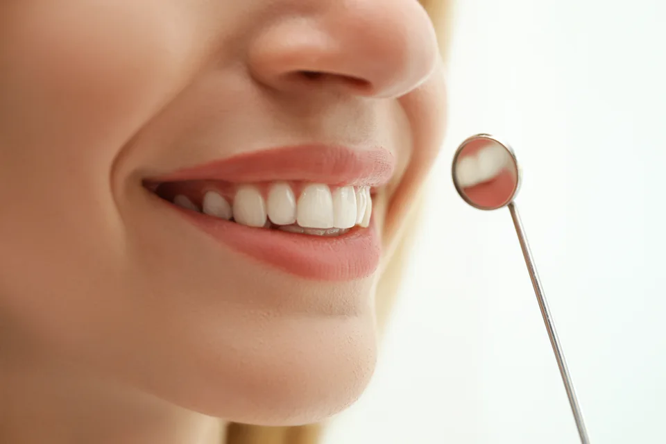 E-Max Empress crown smile detail in Turkey